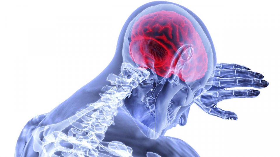 De Ziua Mondială a Accidentului Vascular Cerebral - 29 octombrie -  Medicii avertizeaza: “Din ce in ce mai multi tineri fac AVC! Metoda FAST poate salva vieți”