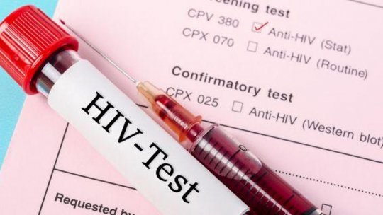 DOCUMENTAR: SIDA - 40 de ani de la apariția unei boli devastatoare