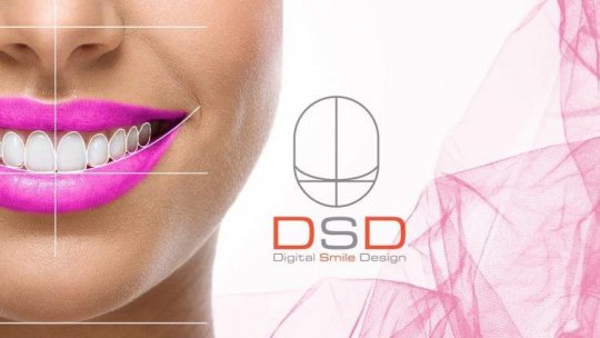 ȘTIINȚA 360 - Digital Smile Design sau Cum să obții un zâmbet perfect?