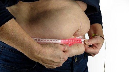 CONSULTAȚII –  Obezitatea, ca boală cronică