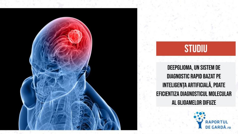 Știința 360 - 4 aprilie 2023 - Raportul de gardă: DeepGlioma, algoritmul AI care detectează mutațiile genetice la pacienții cu gliom în mai puțin de 90 secunde