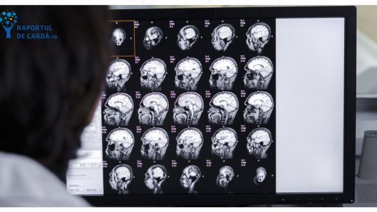 Raportul de gardă: Migrena, cel mai important factor de risc pentru accidentul vascular cerebral la persoanele tinere
