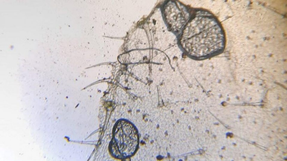 INTROCELL sau cum să descoperi biologia