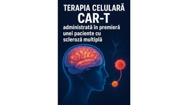 raportuldegarda: Terapia celulară CAR-T, administrată în premieră unei paciente cu scleroză multiplă