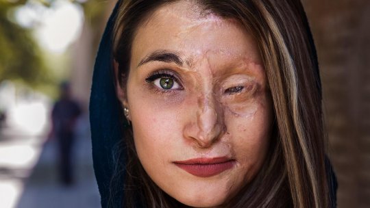Mihaela Noroc: “Toate femeile m-au impresionat, într-un fel sau altul, dar pe fata din Iran, care are jumătate de chip ars cu acid, bineînțeles că n-o s-o pot uita niciodată”